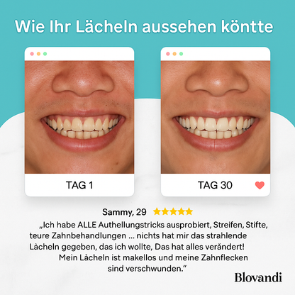 PureSmile Zahnbürste